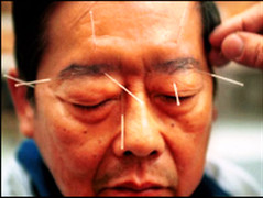 Mùa lạnh: Cảnh giác méo miệng, liệt mặt