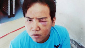 Khi nào bệnh nhân tâm thần phân liệt trở thành sát nhân tàn bạo?