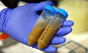 Cậu bé thoát chết ngoạn mục nhờ phân của anh trai