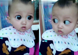 Ăn nhiều nho khi có thai, người phụ nữ choáng khi thấy con mình