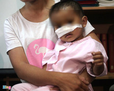 Bác sĩ ám ảnh khi cấp cứu cho hai bé trai bị chó nhà tấn công