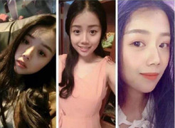 Sợ bệnh nhân chê cười, nữ y tá béo xấu xí lột xác ngoạn mục thành 'nữ thần'