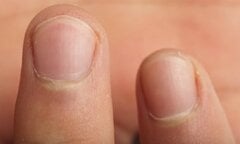 Thường xuyên cho 7 thứ quen thuộc này vào miệng, răng bạn sẽ gặp thảm họa