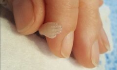 Bà mẹ chia sẻ ảnh bào thai 14 tuần tuổi vì con bị gọi là 'chất thải y tế'