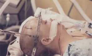 Cô gái tỉnh dậy sau 20 năm hôn mê tiết lộ vẫn nhận biết mọi thứ xung quanh