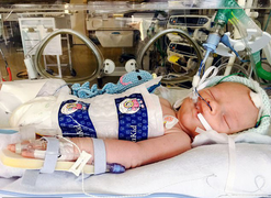 Giáng sinh đầu tiên của em bé 10 ngày tuổi sống sót kỳ diệu sau khi rút máy thở