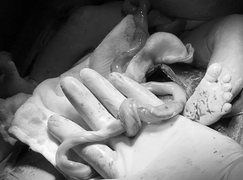 Bác sĩ bỏ ngang ca khám bệnh, lao vào phòng mổ cứu bé sơ sinh