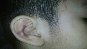 Chấm dứt hợp đồng giáo viên mầm non đánh trẻ ở Cần Thơ