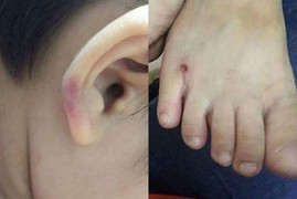 Cô giáo Hà Nội đánh con riêng của chồng nhập viện: Mẹ ruột nén đau quay clip làm bằng chứng