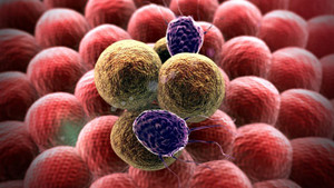 Dấu hiệu ung thư tuổi 50 đừng lơ đi kẻo chết sớm