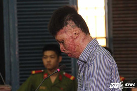 18 năm tù cho kẻ đốt tự đốt mình và người yêu