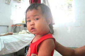 Zika, sốt xuất huyết lây nhanh, thêm chùm ca quai bị xuất hiện trong trường học