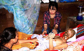 Người đàn ông mắc bệnh lạ bị ăn hết khuôn mặt ở Tiền Giang vẫn có thể được chữa khỏi