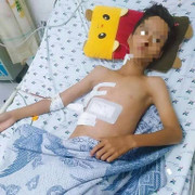 Cứu sống thiếu niên 13 tuổi bị cây sắt máy cắt lúa đâm xuyên ngực