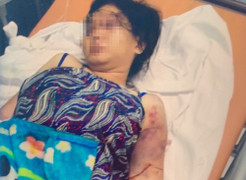 Bắt kẻ chủ mưu thuê người giam giữ, đánh đập cô gái 18 tuổi đến sẩy thai