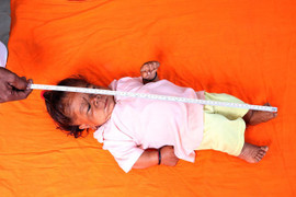 Chàng trai 21 tuổi cao 60 cm được xem như 'thần Hindu'