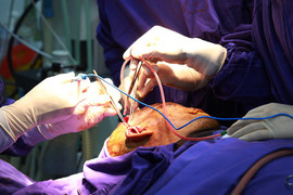 Hãi hùng cảnh gắp gần 100 dị vật ở vùng hàm mặt bệnh nhân 43 tuổi