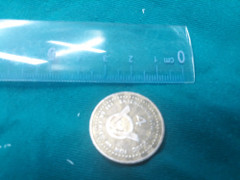 Bé 7 tuổi bị mắc kẹt đồng xu giữa cổ họng