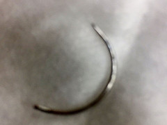 Bác sĩ để quên kim khâu trong vùng kín sản phụ ở Bình Phước