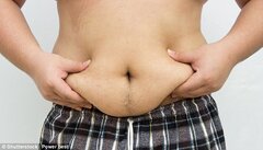 Mỡ bụng - kẻ giết người thầm lặng
