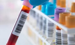 Khám phá mới giải thích vì sao không thể chữa khỏi HIV