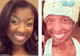 Uống thuốc động kinh, thiếu nữ suýt mất mạng