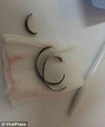 Người đàn ông Thái Lan bị mắc kẹt khi cố đeo nhẫn cho ‘của quý’