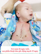 Bác sỹ căng mình 5 tiếng cứu bé sơ sinh bị tim bẩm sinh dạng nặng nhất