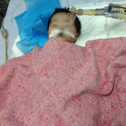 Sức khỏe bé 8 tháng tuổi ở Hà Nội bị nhầm đường dùng thuốc ra sao?