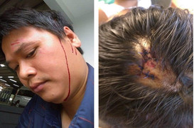 Khách hàng khiếu nại, 2 nhân viên gara ô tô lao vào hành hung