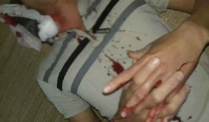 Điều tra nghi vấn đạn lạc rơi trúng cổ nam thanh niên ở Hòa Bình