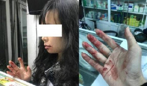 Nữ hành khách bị tài xế hành hung, nhắn tin đe doạ: Công an vào cuộc điều tra