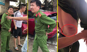 Thêm chiến sĩ công an bị tài xế xe tải chống lệnh, tông bị thương