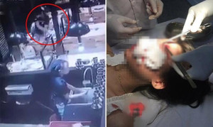 Chỉ vì một câu nói, cô gái bị nam thanh niên dùng cốc ném rách mặt