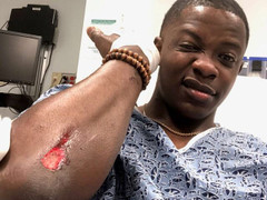 Chàng trai anh hùng cứu sống hàng loạt người trong vụ xả súng chấn động ở Mỹ