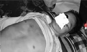 Chết bất thường khi trở về từ trụ sở công an: Triệu tập một số công an xã