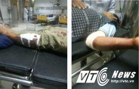 Quay cảnh 2 người cãi nhau, nam thanh niên bị hành hung dã man