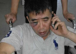 Nhóm côn đồ hung hãn lao vào nhà dân đập phá, đánh 3 bố con trọng thương