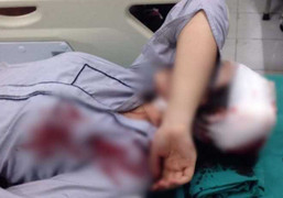 Nữ sinh lớp 10 bị bạn dùng gậy sắt đánh nhập viện