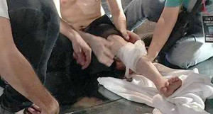 Đàm Vĩnh Hưng gặp tai nạn ngay trước thềm live show