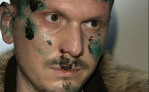 Kẻ định tấn công Tổng thống Putin bị bắn trọng thương