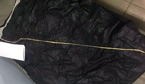 Phát hiện sán dài hơn 1 m trong bụng nữ bệnh nhân