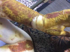 Chủ tịch Hà Nội yêu cầu xử nghiêm vụ nữ sinh lớp 12 bị bỏng