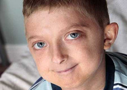 Cậu bé 11 tuổi già nhanh gấp 5 lần bình thường