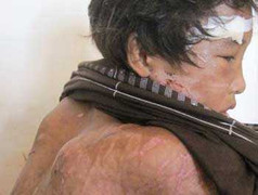 Vụ em Bình, Hào Anh và niềm tin của 1 cặp vợ chồng