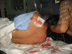 Kẻ si tình hành hung cô giáo trẻ dã man