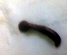 Phát hiện vắt rừng dài 10cm ký sinh trong khí quản