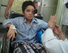 Cắt bỏ khối u to ở mắt cho BN bị chứng máu khó đông