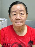 Kết luận ban đầu bệnh 'cô gái hóa bà lão' ở Bến Tre