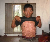 Người đàn ông nhặt rác mang 'thân hình quỷ' ở Hà Nội